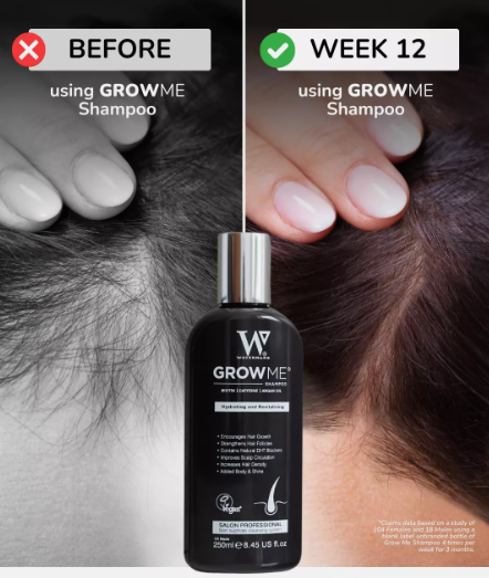 Hair Growth Shampoo(250ml) (Original)