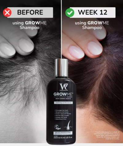 Hair Growth Shampoo(250ml) (Original)